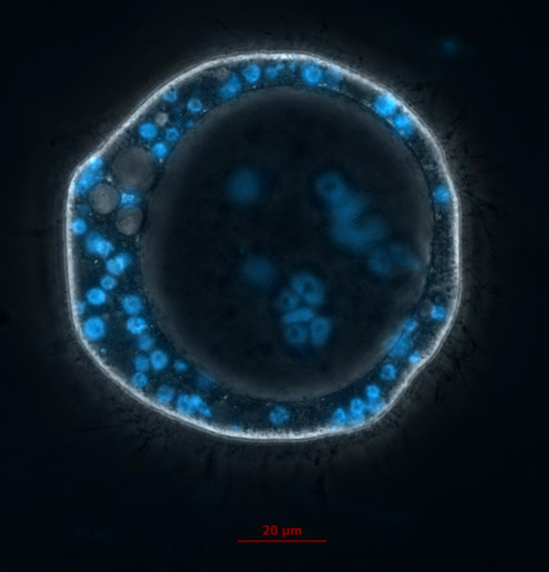 Vacuolated coenocytic form of Abeoforma whisleri