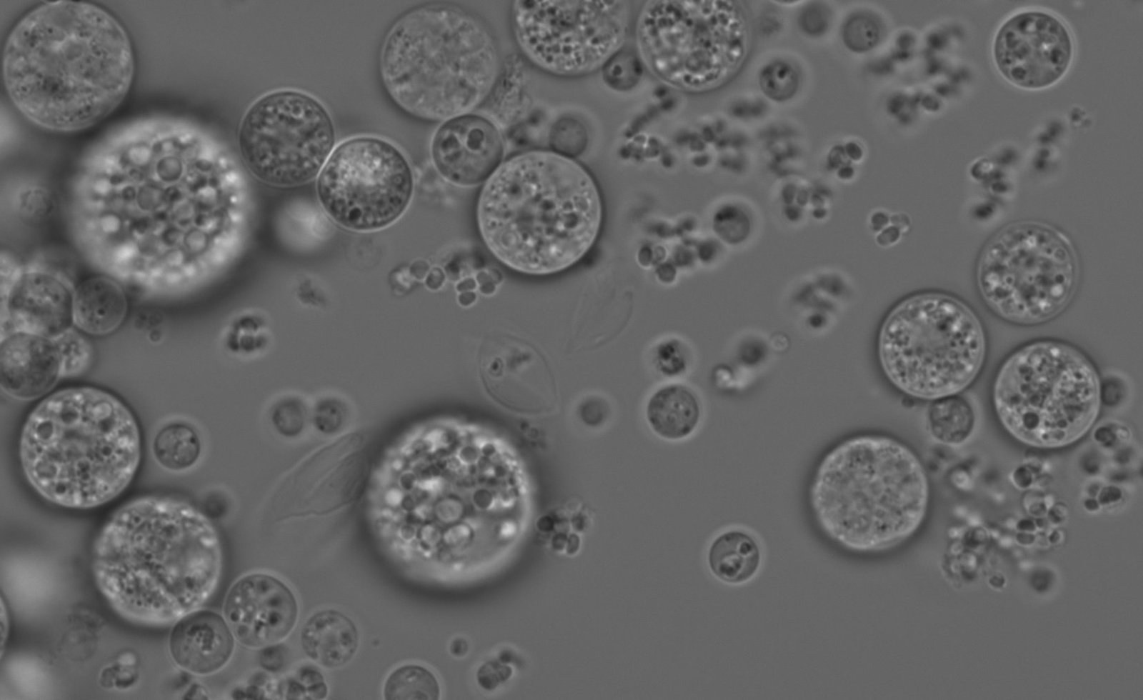Chromosphaera perkinsii observed by microscopy