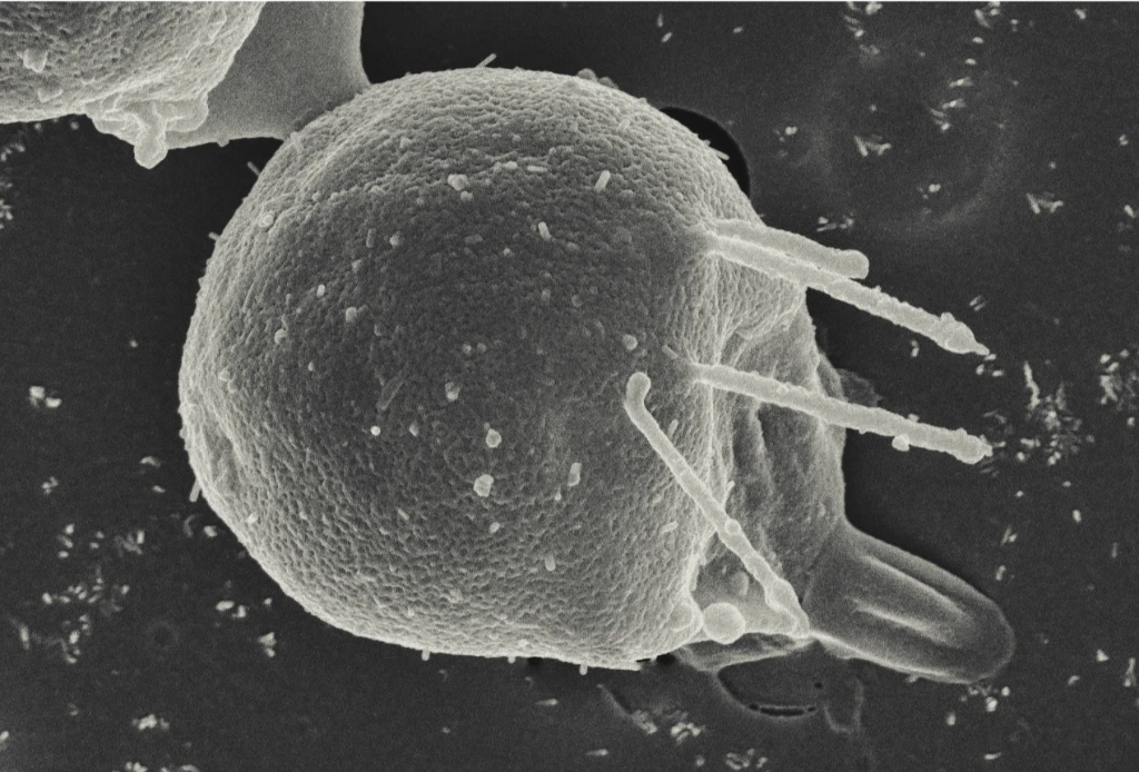 Research image associated with Corallochytrium limacisporum