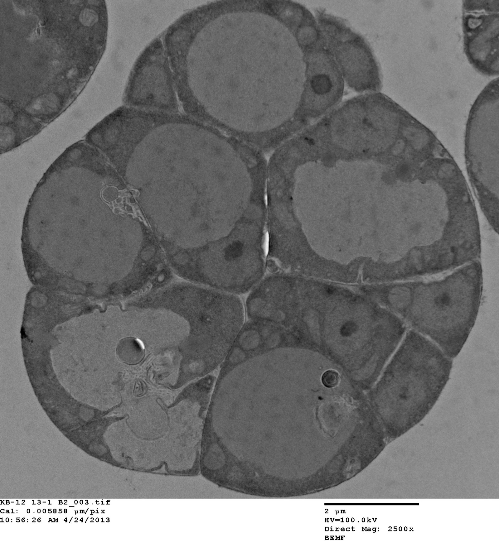 Transmission electron micrograph of Corallochytrium cell division