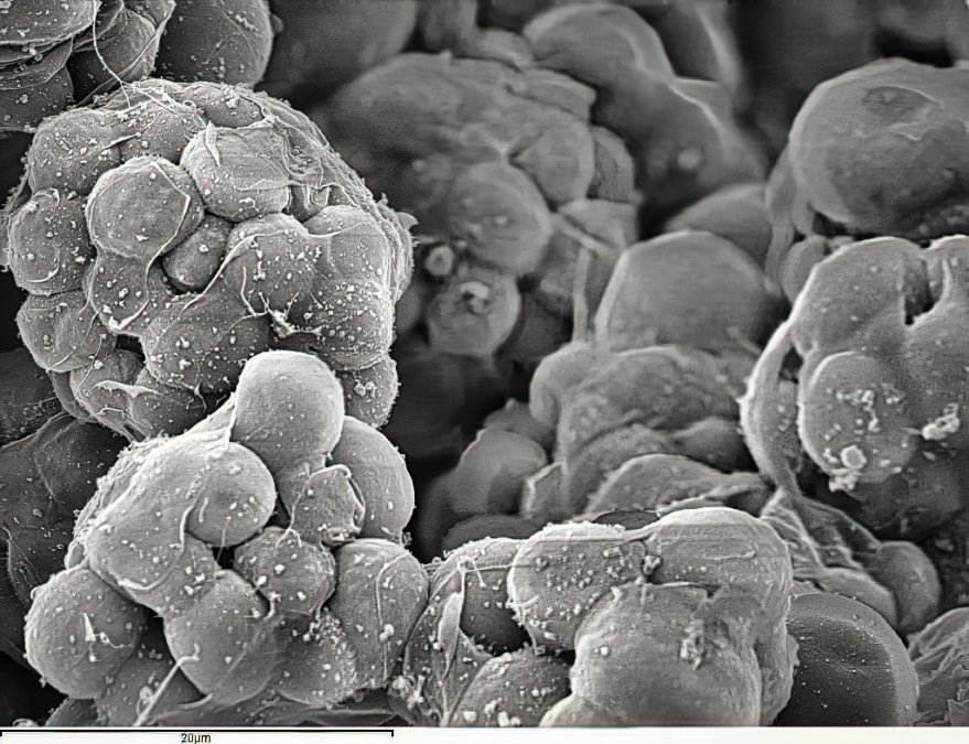 Scanning electron micrograph of cellularized Creolimax coenocytes