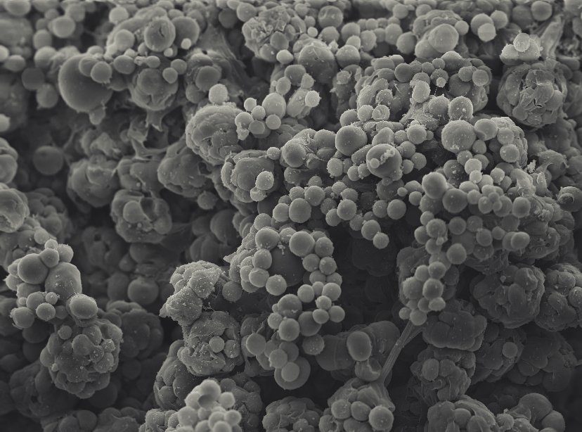 Scanning electron micrograph showing many Creolimax developmental stages