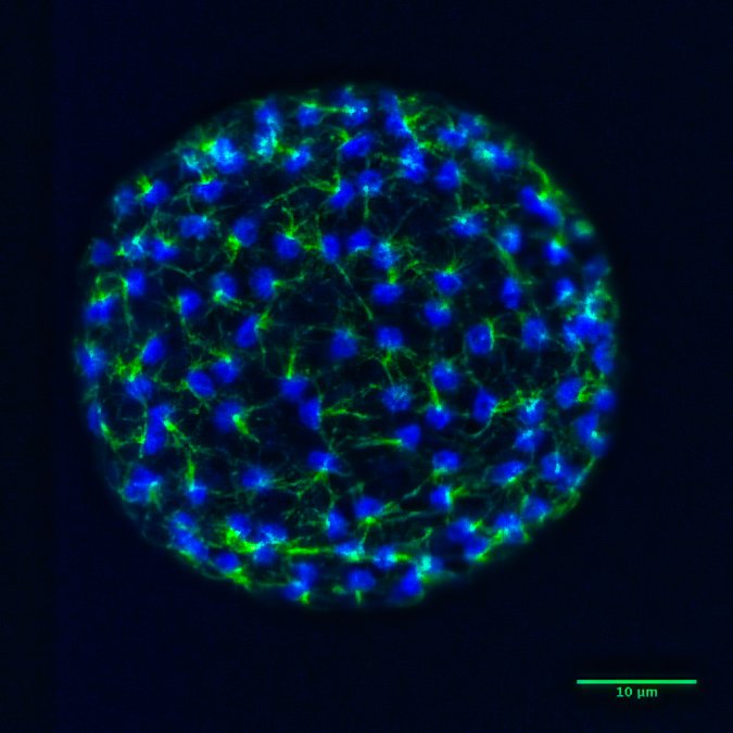 Fluorescence microscopy of a cellularizing Creolimax fragrantissima coenocyte