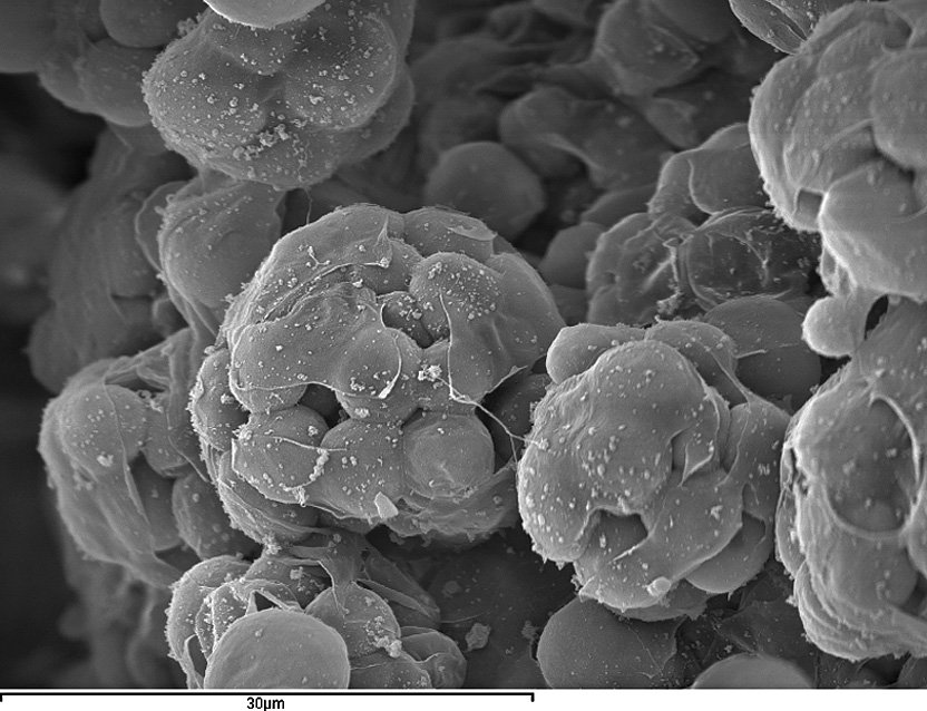 Scanning electron micrograph of daughter cells emerging from Creolimax